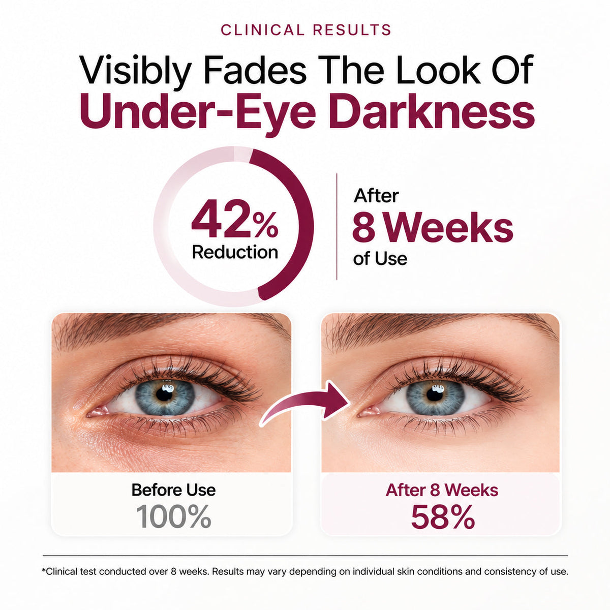 P7 Eye Renewal Crème — 7