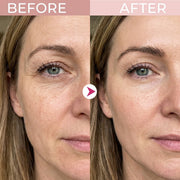 P7 Eye Renewal Crème — 2
