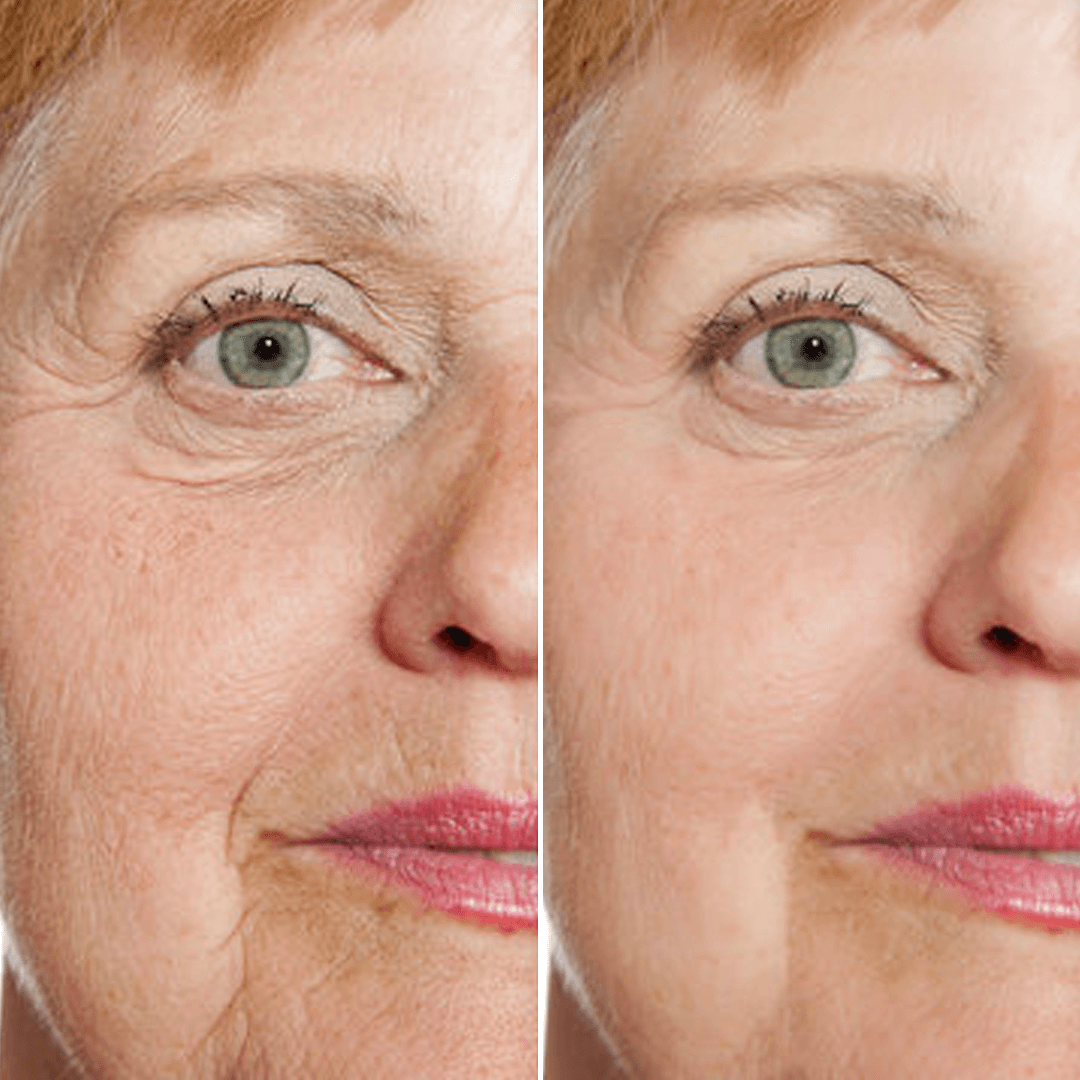 Rejuvenate Face Serum 4