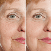 Rejuvenate Face Serum 4