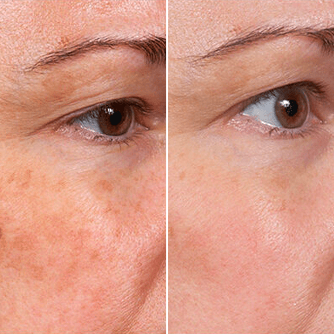 Rejuvenate Face Serum 5