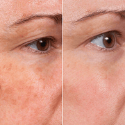 Rejuvenate Face Serum 5