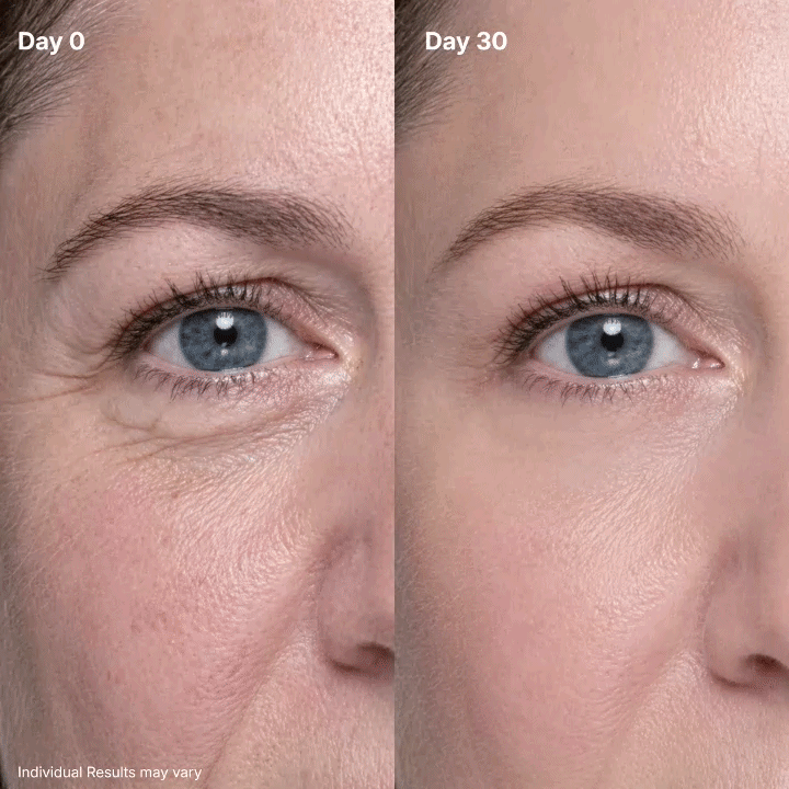 P7 Eye Renewal Crème — 6