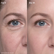P7 Eye Renewal Crème — 6